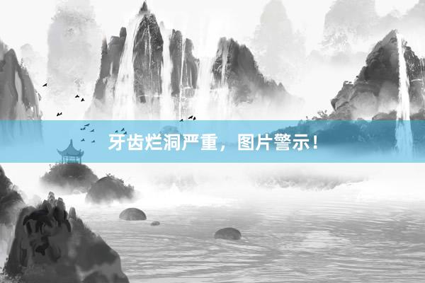 牙齿烂洞严重，图片警示！